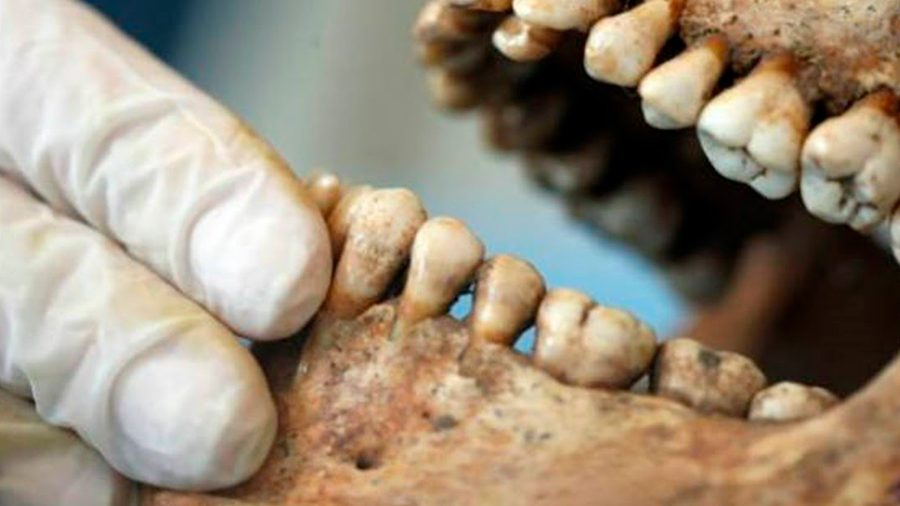 Odontología Forense: Tercer método de identificación de cadáveres más utilizado a nivel nacional